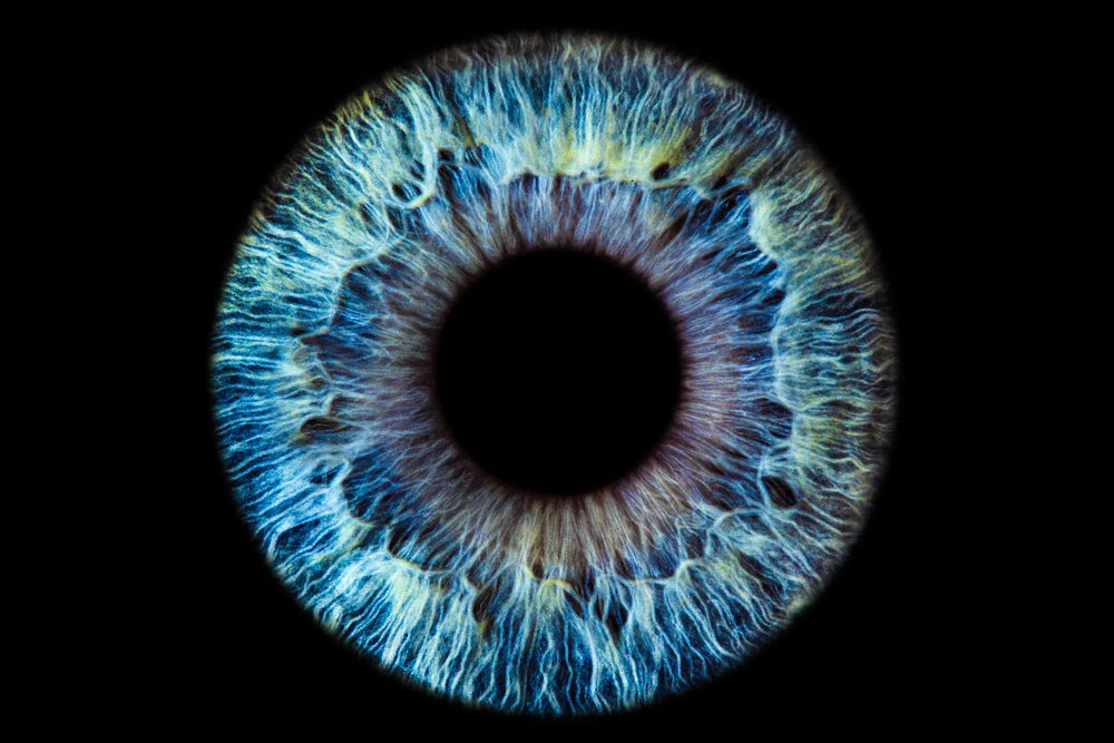 Iridocyclitis: Definition, Causes, and Treatment